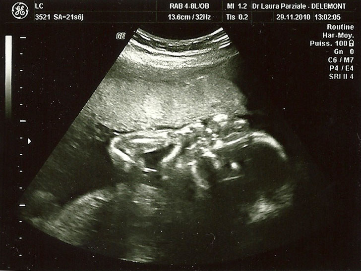 Echographie_20101129_130205.jpg