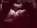 Echographie_20090925.jpg